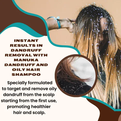 Vista 7 de Manuka Champú anticaspa y cabello graso, eficaz desde el primer uso, reduce la caspa grasa, alivia la picazón y el enrojecimiento, repara la barrera