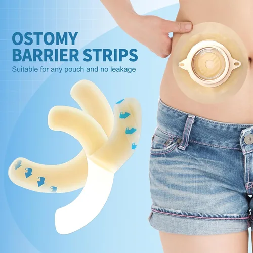 Vista 6 de 30 suministros de ostomía, tiras de barrera para ostomía, tiras de cinta adhesiva de barrera elástica para bolsas de colostomía, cinta de ileostomía