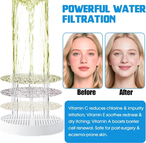 Vista 4 de xcivi Cartucho de repuesto de filtro de ducha con vitamina C + E + A para cabezal de ducha Aquahomegroup, filtro de cabezal de ducha que soporta