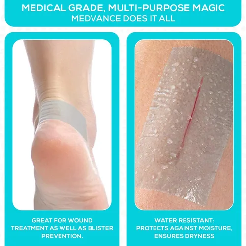 Vista 6 de Medvance Cinta de silicona suave con perforación para un tamaño fácil de cortar, 1 pulgada de ancho (1 paquete, 1.5 yardas)