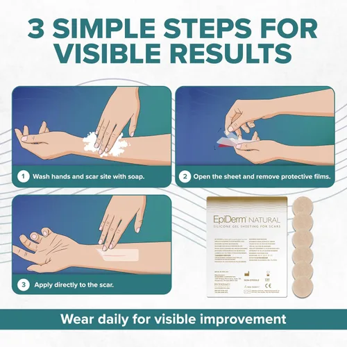 Vista 8 de Epiderm - Círculos de silicona para cicatrices – Parches de cicatriz de silicona para cara y cuerpo – Puntos adhesivos reutilizables para cicatrices