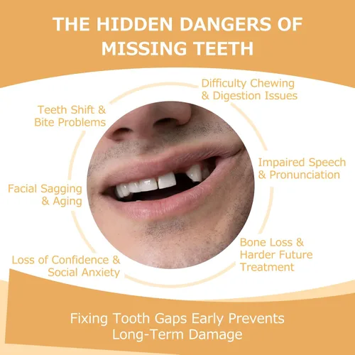 Vista 6 de Prótesis parciales – Dentaduras postizas para dientes perdidos y huecos – Dientes de repuesto ligeros e irrompibles para hombres y mujeres (1 diente)