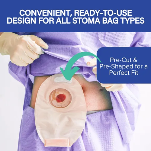 Vista 6 de 20 tiras de barrera para ostomía, elásticas, a prueba de fugas, impermeables, para la piel, suministros de ostomía hidrocoloide, tira adhesiva