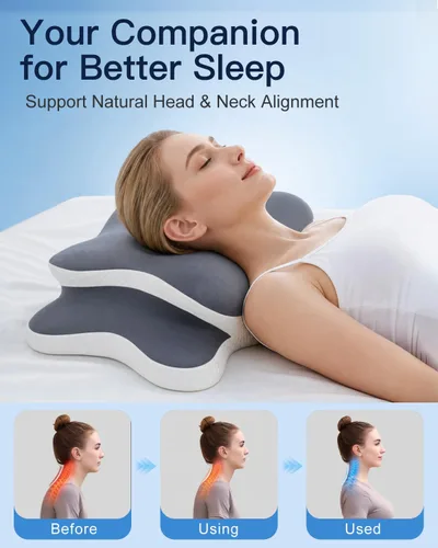 Vista 2 de Almohada cervical ergonómica para aliviar el dolor de cuello Gris