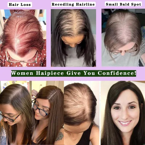 Vista 5 de Voloria Toppers de cabello humano real de 12 pulgadas para mujer, densidad media, base de poliuretano completa, extensiones de cabello