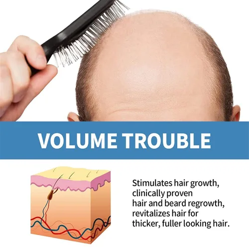 Vista 2 de React Minoxi - Tratamiento para el cabello enrollable nuevo suero para el crecimiento del cabello aceite nutritivo natural para el cuero cabelludo