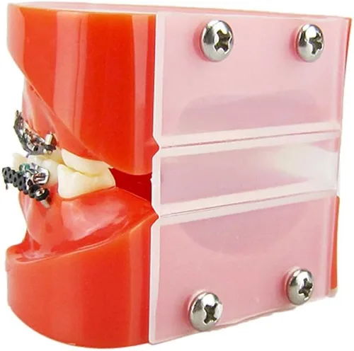 Vista 4 de Modelo de educación de demostración dental para mostrar ortodoncia Maloclusión Braces Dientes Modelo 1pc/pk