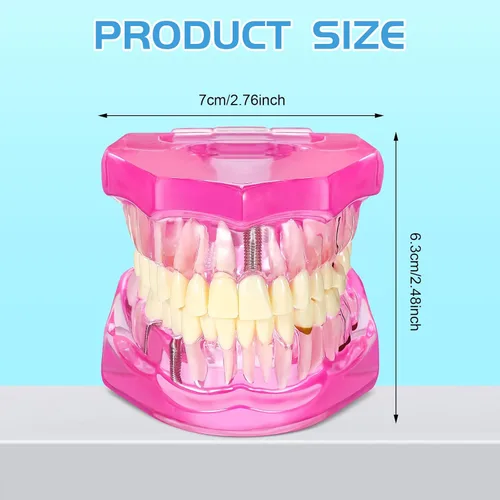 Vista 2 de Modelo de dientes con enfermedad de Outus, modelo de implante dental con dientes removibles, estándar de dientes patológicos para demostración