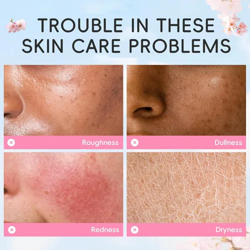 Vista 7 de Sakura - Set de cuidado de la piel para mujeres, regalos de cumpleaños para adolescentes, cuidado de la piel para niños, cuidado de la piel