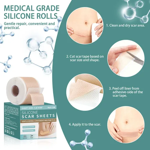 Vista 4 de Hojas de silicona para cicatrices quirúrgicas, reutilizables, cinta de silicona profesional para la cara, acné, cesárea, estrías, golpes queloides
