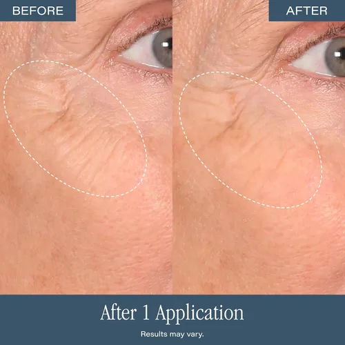 Vista 8 de SKINN DermAppeal - Exfoliante facial de microdermoabrasión, 2 onzas