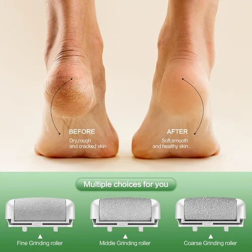 Vista 2 de Removedor eléctrico de callos de pies, lima de pie eléctrico con luz LED y pantalla, limpiador eléctrico recargable e impermeable, 3 rodillos