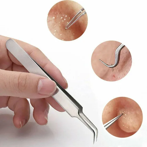 Vista 2 de Kit de herramientas para eliminar puntos negros, kit de 9 piezas, herramienta profesional de extracción de espinillas de acero inoxidable