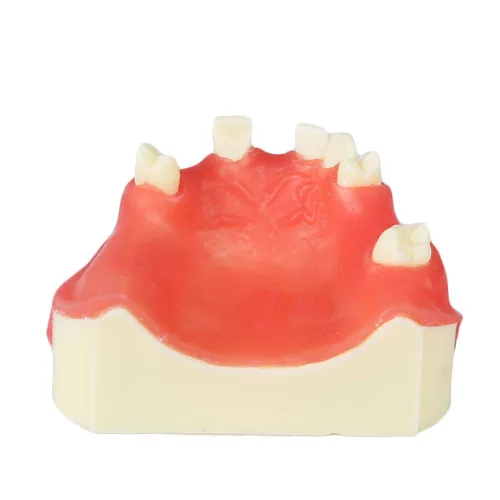 Vista 5 de Modelo de implante maxilar rojo dental con modelo de educación modelo de práctica de silicona suave