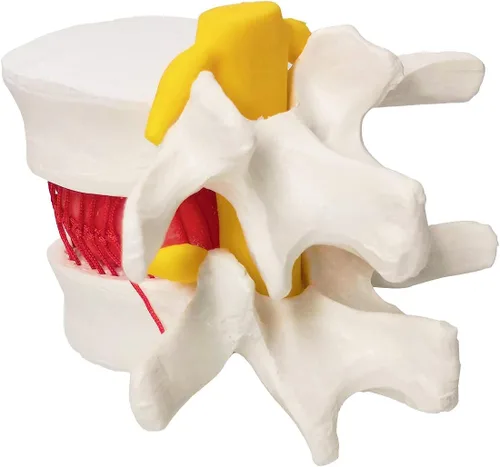Vista 4 de EVOTECH SCIENTIFIC Modelo de disco hernia humana, hernia anatómica de vértebras lumbares modelo de prolapso de disco para enseñanza médica