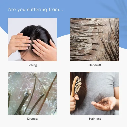 Vista 4 de GiveMeWater Shampoo - Solución profesional para la pérdida de cabello para hidratar y calmar el cuero cabelludo seco (12.17 fl oz)