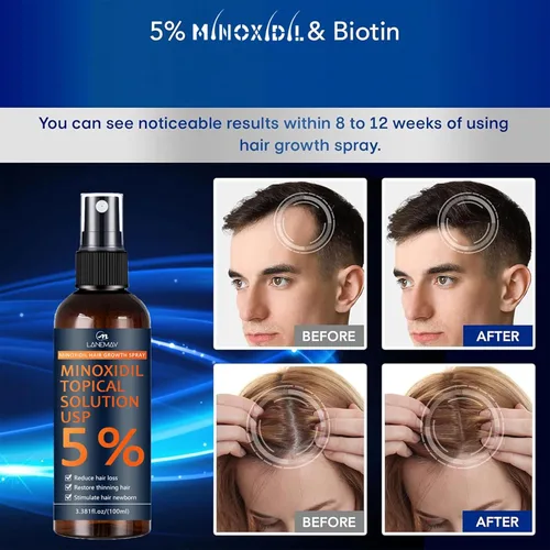 Vista 6 de Minoxidil - Kit de crecimiento de barba para hombres, minoxidil para mujeres, kit de crecimiento del cabello, tratamientos de pérdida de cabello