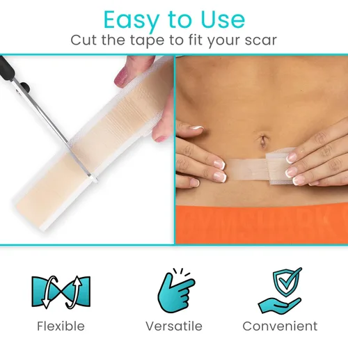 Vista 5 de ViveCare - Cinta de silicona para cicatrices (rollo de 1.6 x 120 pulgadas), cinta de silicona de grado médico para cicatrices quirúrgicas, sección
