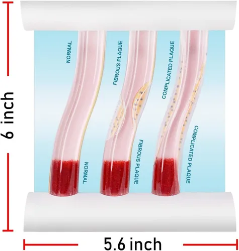 Vista 3 de Medarchitect Modelo de vaso sanguíneo LDL de la lipoproteína de baja densidad para la enseñanza del médico del paciente médico