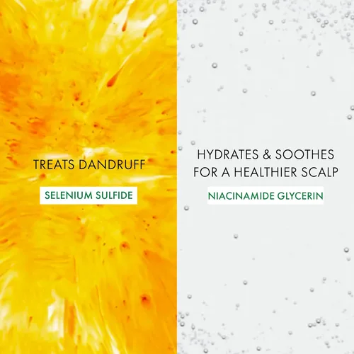 Vista 5 de VICHY Dercos Dandruff Shampoo, Antifungal Dry Scalp Treatment & Itchy Scalp Relief, Prescription Strength Selenium Sulfide Comparable to 2%