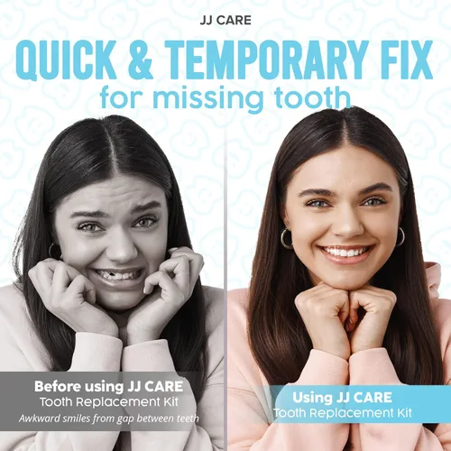 Vista 2 de JJ CARE Kit de reemplazo temporal de dientes con herramientas dentales, relleno de dientes termoplásticos moldeables para huecos, dientes faltantes