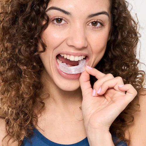 Vista 8 de Bandejas blanqueadoras de dientes precargadas – 12% de peróxido de hidrógeno, kit de blanqueamiento de grado dentista