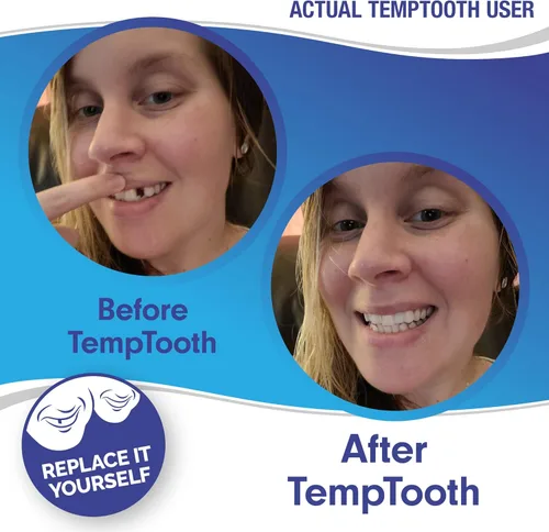 Vista 3 de El producto de sustitución dentaria temporal n.'º 1 en ventas, con herramientas dentales gratuitas, de Temptooth