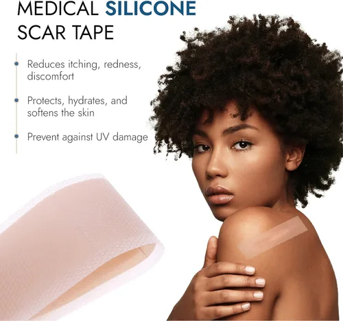 Vista 4 de Scarbandit Cinta de silicona para cicatrices – Hojas de cicatrices para eliminación de protuberancias queloides, abdominoplastia, cesárea