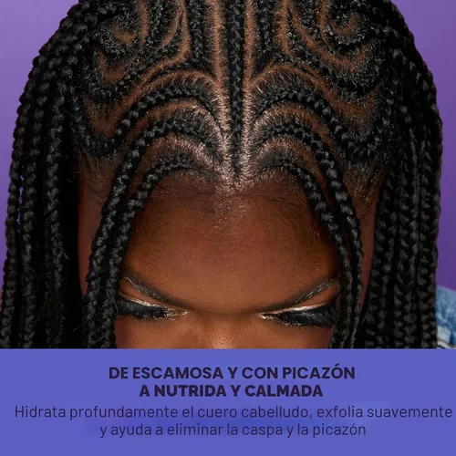 Vista 6 de Shea Moisture Tratamiento de la caspa El suero para el cuero cabelludo