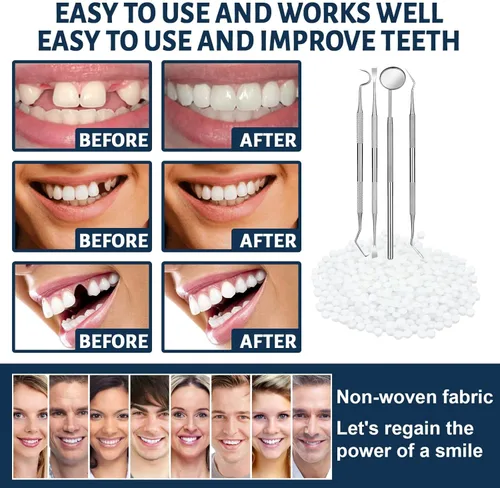 Vista 5 de Kit de reparación de dientes – Kit de reemplazo temporal de dientes falsos con herramientas de espejo dental para la restauración temporal