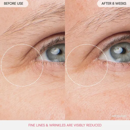 Vista 5 de LANEIGE - Mascarilla nocturna para labios: Nutrir, hidratar, vitamina C, manteca de murumuru y manteca de karité, antioxidantes, labios escamosos